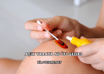 Açık Yaraya Ne İyi Gelir?