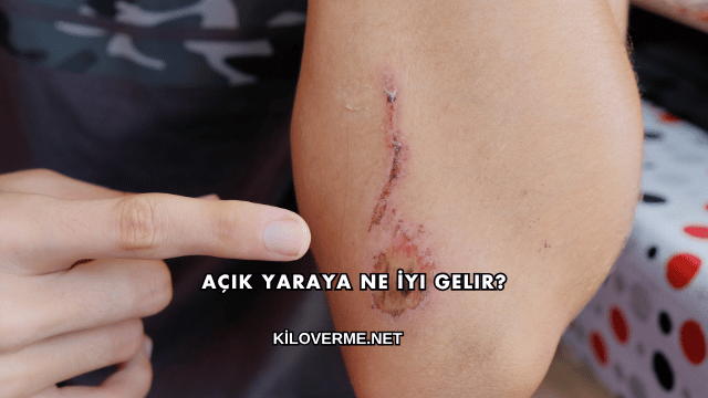 Açık Yaraya Ne İyi Gelir?