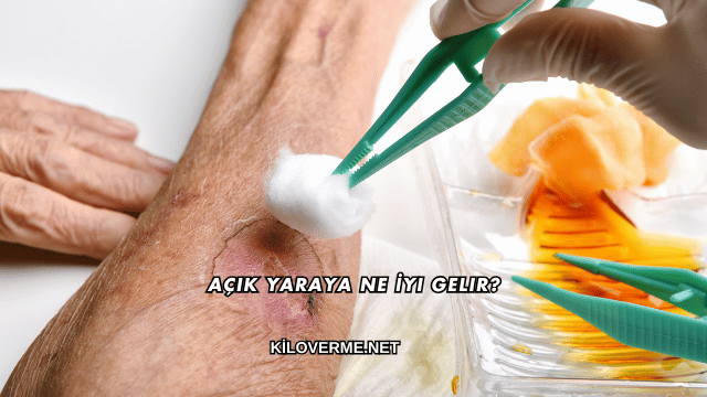 Açık Yaraya Ne İyi Gelir?