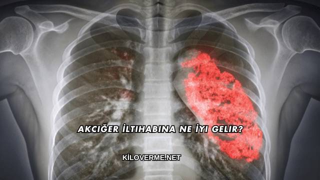 Akciğer İltihabına Ne İyi Gelir?