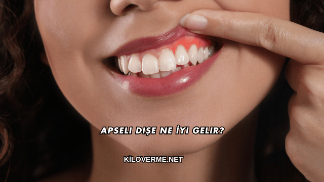 Apseli Dişe Ne İyi Gelir?