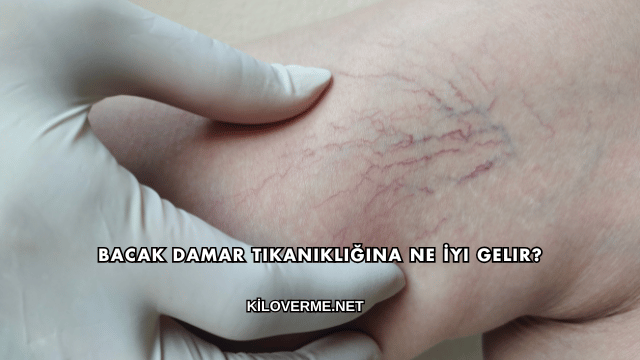 Bacak Damar Tıkanıklığına Ne İyi Gelir?