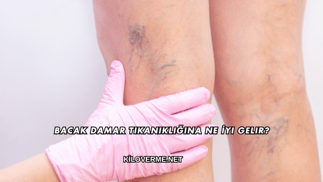 Bacak Damar Tıkanıklığına Ne İyi Gelir?