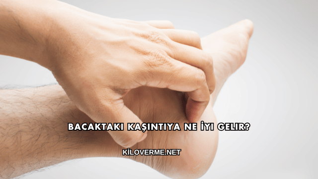 Bacaktaki Kaşıntıya Ne İyi Gelir?