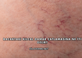 Bacaktaki Kılcal Damar Çatlamasına Ne İyi Gelir?