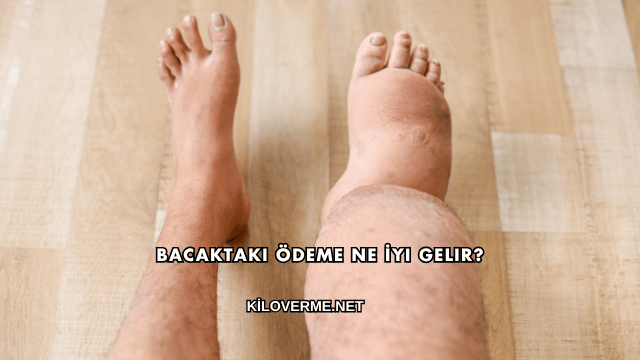 Bacaktaki Ödeme Ne İyi Gelir?