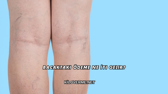 Bacaktaki Ödeme Ne İyi Gelir?