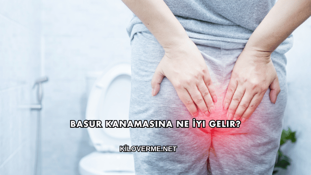 Basur Kanamasına Ne İyi Gelir?