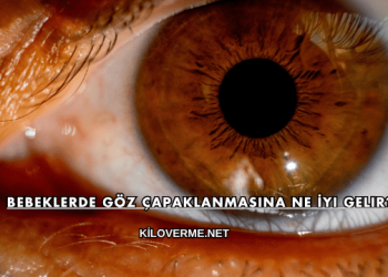 Bebeklerde Göz Çapaklanmasına Ne İyi Gelir?