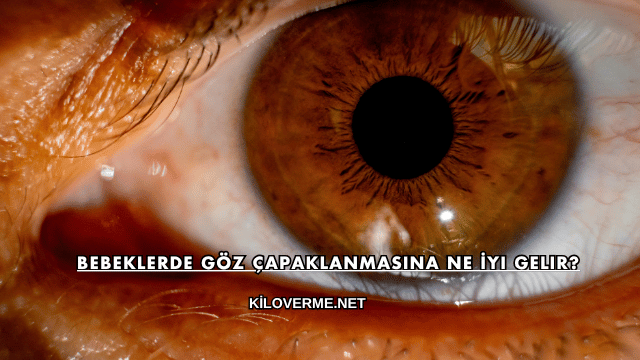 Bebeklerde Göz Çapaklanmasına Ne İyi Gelir?