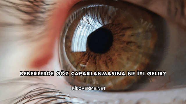 Bebeklerde Göz Çapaklanmasına Ne İyi Gelir?