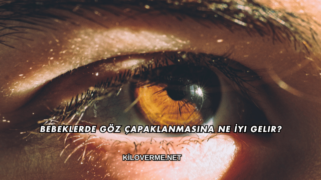 Bebeklerde Göz Çapaklanmasına Ne İyi Gelir?