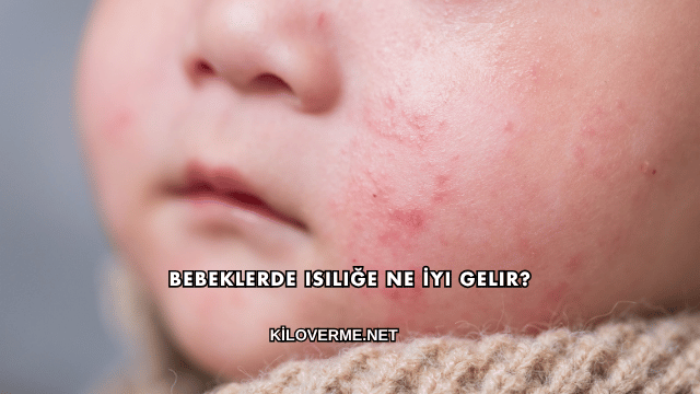 Bebeklerde Isiliğe Ne İyi Gelir?