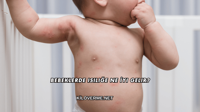 Bebeklerde Isiliğe Ne İyi Gelir?