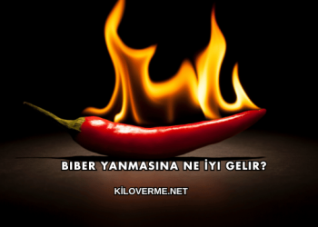 Biber Yanmasına Ne İyi Gelir?