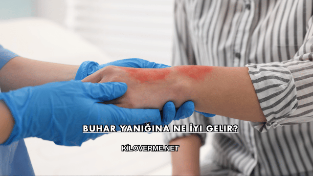 Buhar Yanığına Ne İyi Gelir?