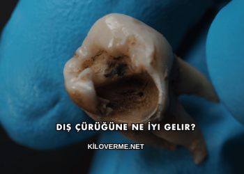 Diş Çürüğüne Ne İyi Gelir?