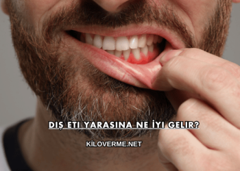 Diş Eti Yarasına Ne İyi Gelir?