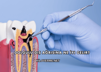 Dolgulu Diş Ağrısına Ne İyi Gelir?