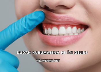 Dudak Kurumasına Ne İyi Gelir?