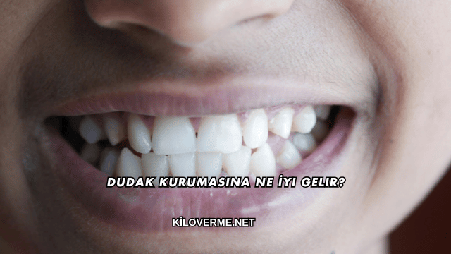 Dudak Kurumasına Ne İyi Gelir?