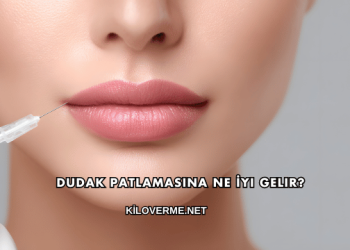 Dudak Patlamasına Ne İyi Gelir?