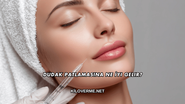 Dudak Patlamasına Ne İyi Gelir?