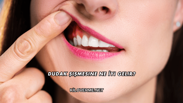 Dudak Şişmesine Ne İyi Gelir?