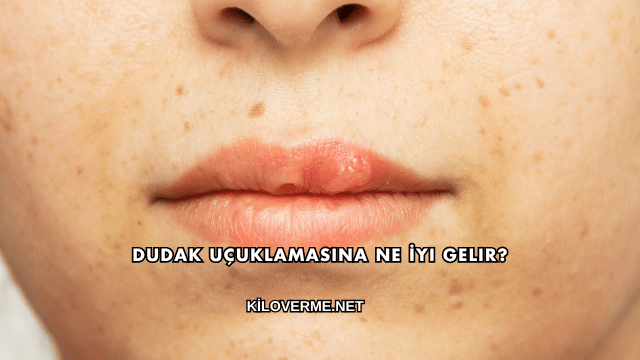Dudak Uçuklamasına Ne İyi Gelir?