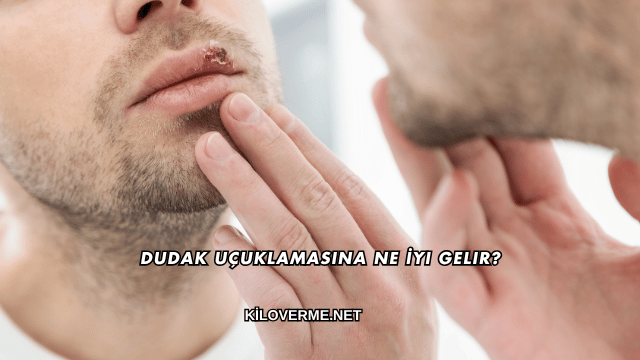 Dudak Uçuklamasına Ne İyi Gelir?