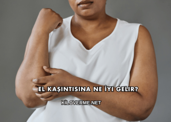 El Kaşıntısına Ne İyi Gelir?
