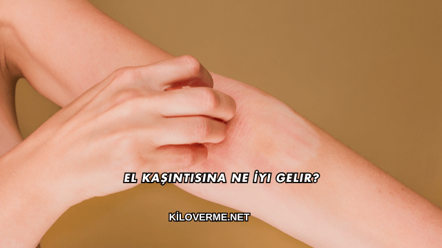 El Kaşıntısına Ne İyi Gelir?