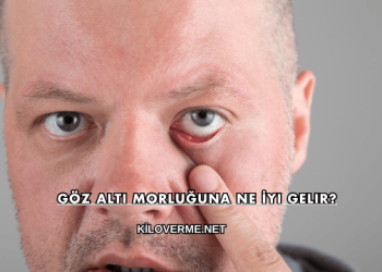 Göz Altı Morluğuna Ne İyi Gelir?