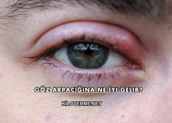 Göz Arpacığına Ne İyi Gelir?