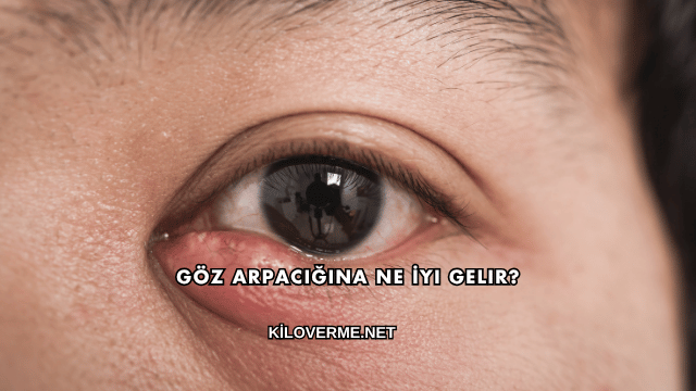 Göz Arpacığına Ne İyi Gelir?