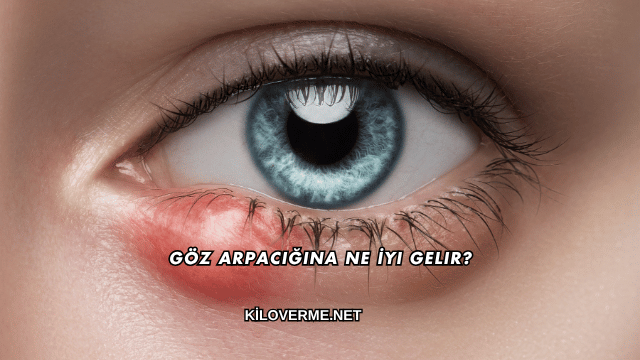 Göz Arpacığına Ne İyi Gelir?