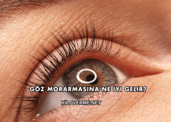 Göz Morarmasına Ne İyi Gelir?