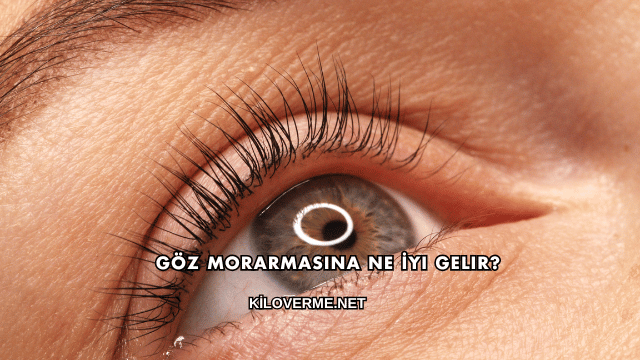 Göz Morarmasına Ne İyi Gelir?