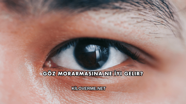 Göz Morarmasına Ne İyi Gelir?