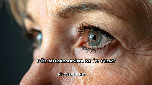 Göz Morarmasına Ne İyi Gelir?