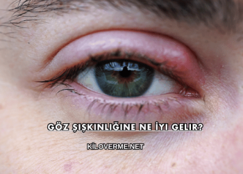 Göz Şişkinliğine Ne İyi Gelir?
