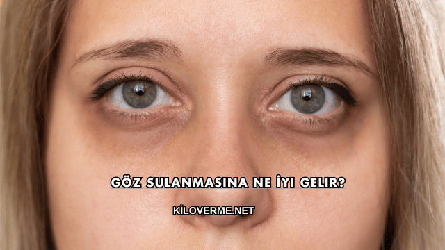 Göz Sulanmasına Ne İyi Gelir?