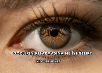 Gözlerin Kızarmasına Ne İyi Gelir?