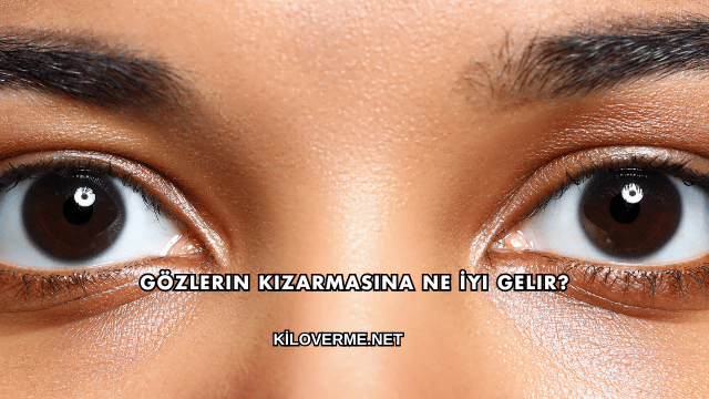 Gözlerin Kızarmasına Ne İyi Gelir?
