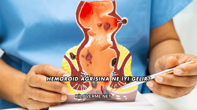 Hemoroid Ağrısına Ne İyi Gelir?