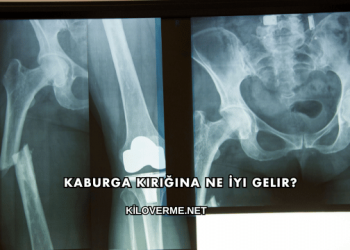 Kaburga Kırığına Ne İyi Gelir?