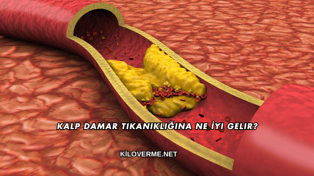 Kalp Damar Tıkanıklığına Ne İyi Gelir?