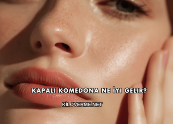 Kapalı Komedona Ne İyi Gelir?