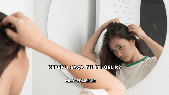 Kepekli Saça Ne İyi Gelir?