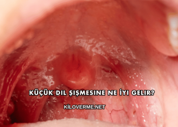 Küçük Dil Şişmesine Ne İyi Gelir?